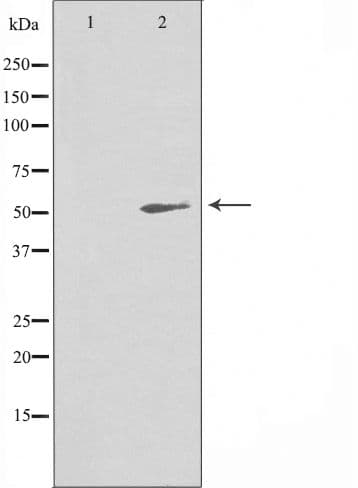 Polyclonal Rabbit anti-Human PA26 / SESN1 Antibody (aa138-163, IHC, WB)