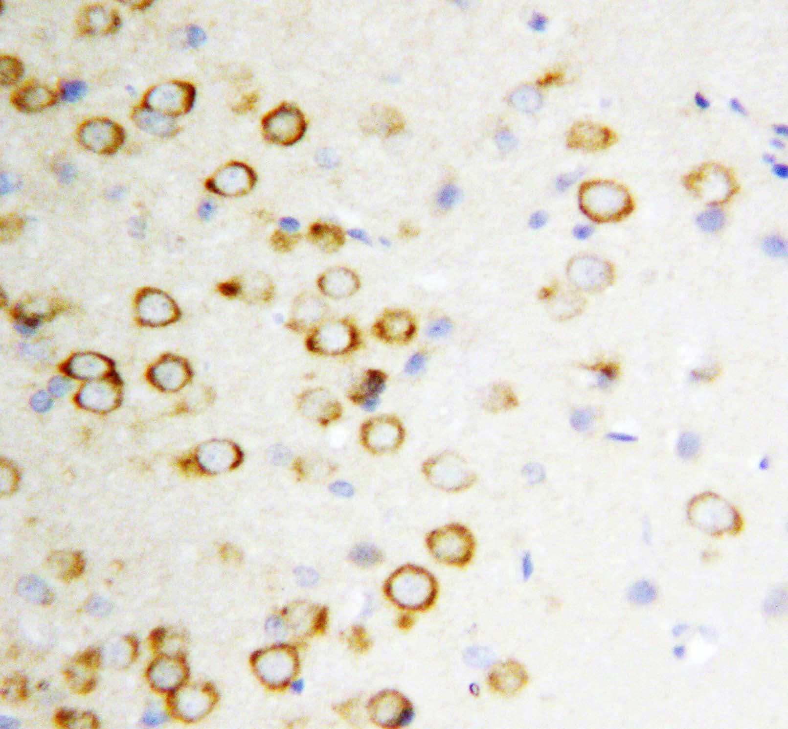 Polyclonal Rabbit anti-Human GDNF Antibody (aa142-158, IHC, WB)
