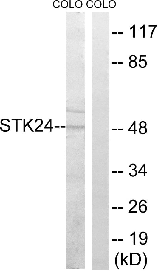 STK24 / MST3 Antibody (aa319-368)