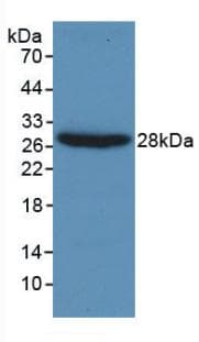 GSN / Gelsolin Antibody (aa432-553)