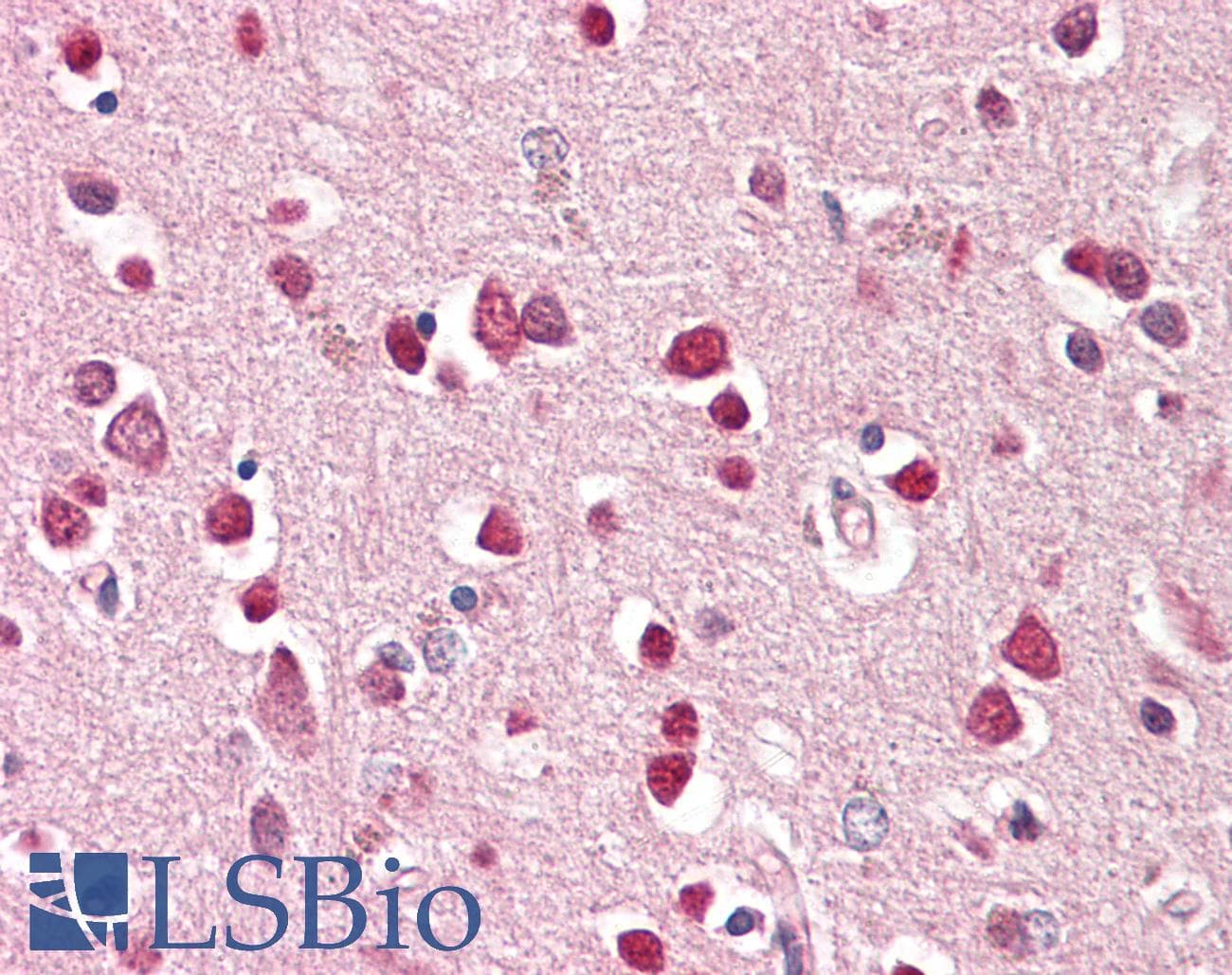 IHC-plus™ GRIK1 / GLUR5 Antibody (aa878-889)
