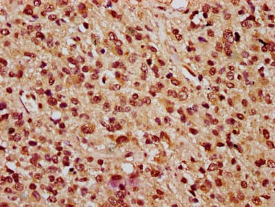 Polyclonal Rabbit anti-Human PARP3 Antibody (IHC, WB)