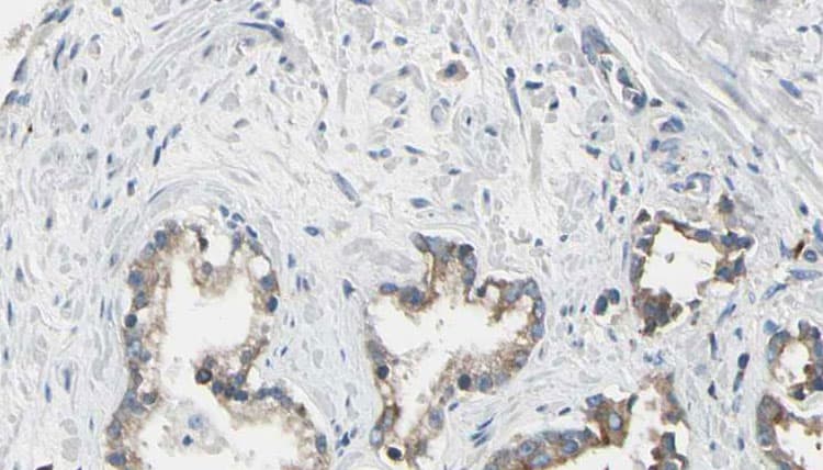 CHML Antibody