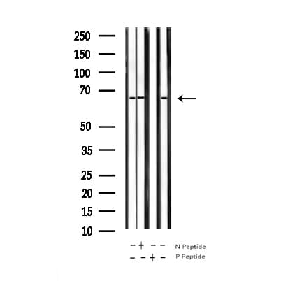 RELA / NFKB p65 Antibody (phospho-Ser281)