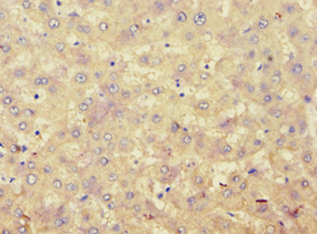 Polyclonal Rabbit anti-Human ACAT1 Antibody (aa1-145, IHC, WB)