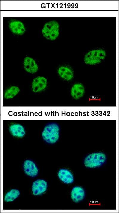 POLR3E / SIN Antibody