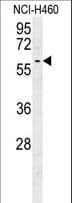 Polyclonal Rabbit anti-Human DYNC1LI2 Antibody (aa152-180, IHC, WB)