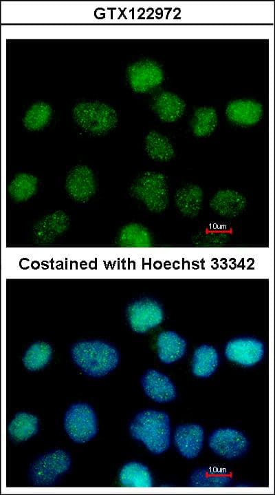ZNF597 Antibody