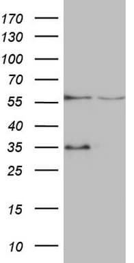 VPS13B Antibody (aa91-346, clone OTI6F6, Carrier-free)