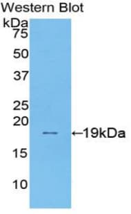 SI / Sucrase Isomaltase Antibody (aa1717-1827, HRP)