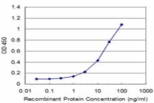 Recoverin Antibody (clone 3F6)