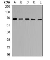IHC-plus™ RPN2 / Ribophorin II Antibody
