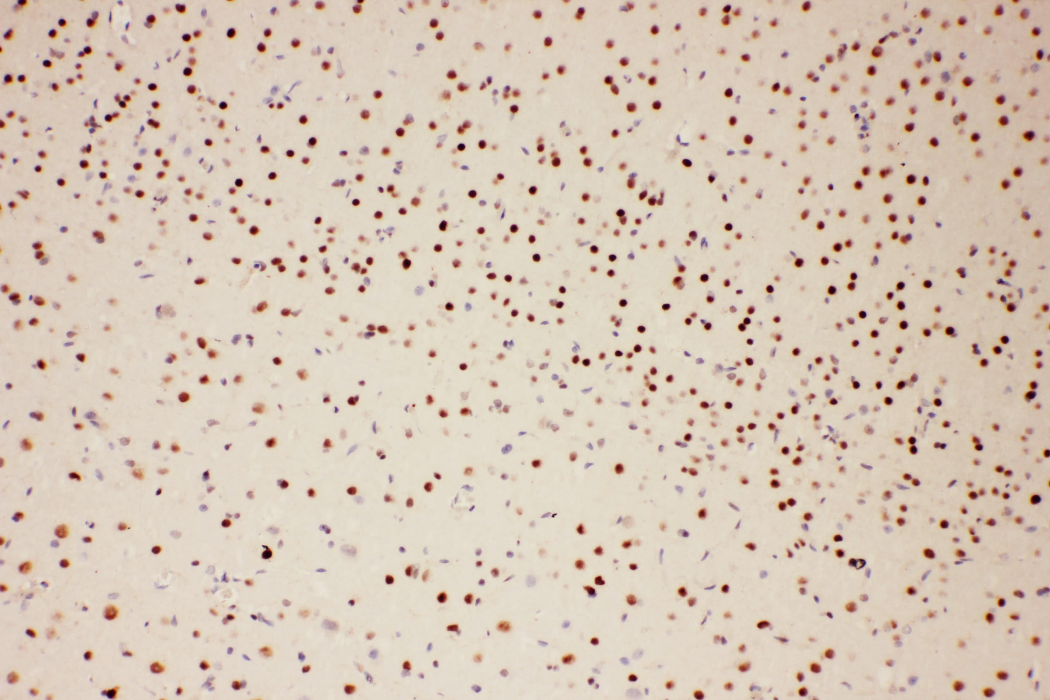 PIAS1 Antibody (aa636-651)