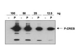 Polyclonal Rabbit anti-Human CREB1 / CREB Antibody (phospho-Ser133, IHC, IF, WB)