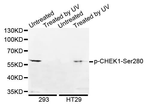 CHEK1 / CHK1 Antibody (phospho-Ser280)
