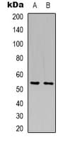 SLC2A5 / GLUT5 Antibody (N-Terminus)