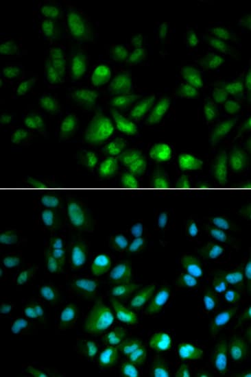 Polyclonal Rabbit anti-Human USF1 / USF Antibody (IHC, IF, WB)