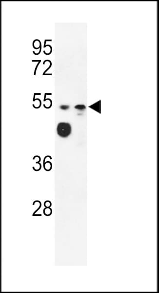 Polyclonal Rabbit anti-Human MARVELD2 / Tricellulin Antibody (aa386-415, IHC, WB)
