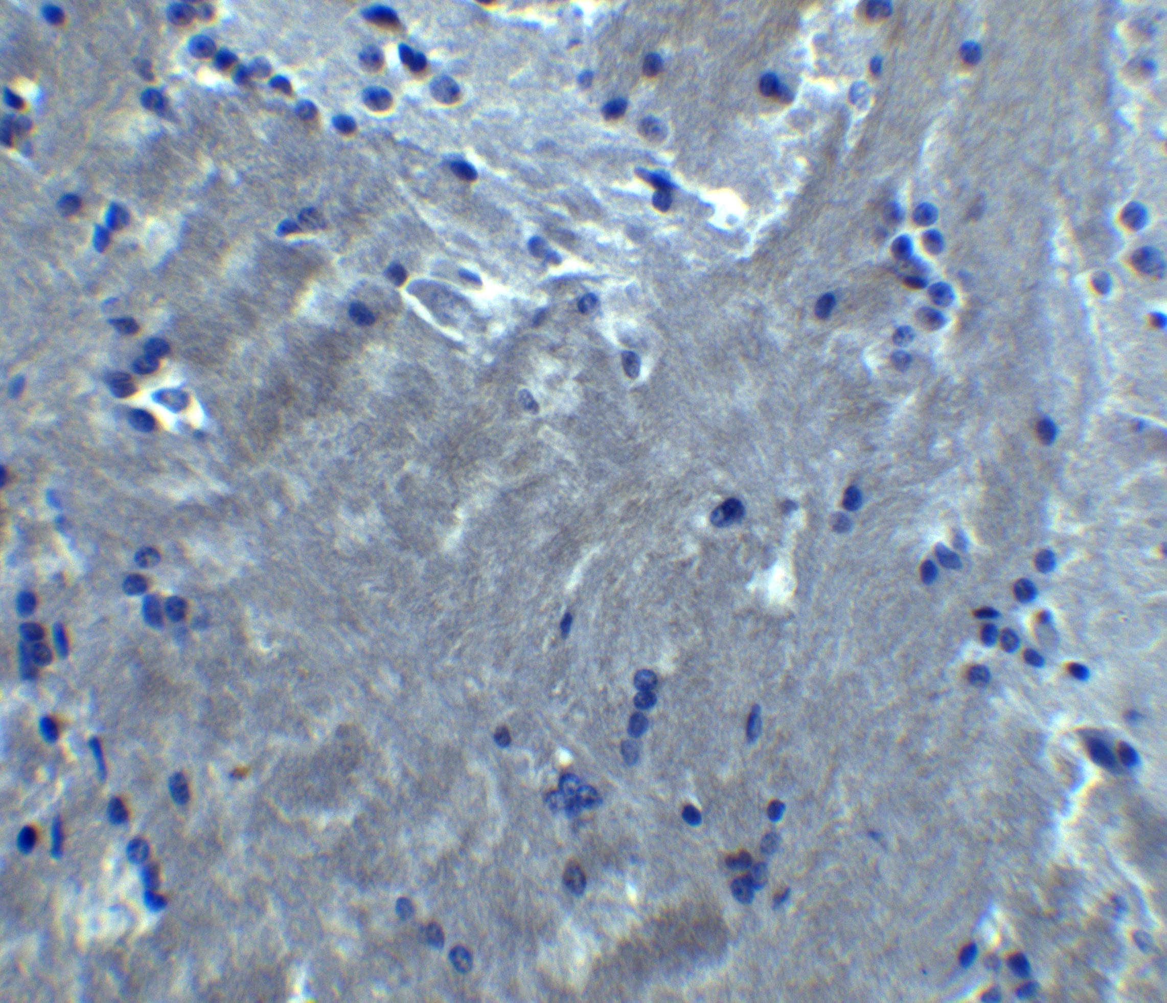 SIPR2 / S1P2 / EDG5 Antibody