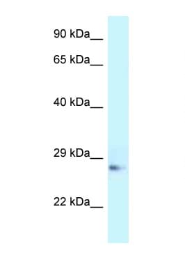 Polyclonal Rabbit anti-Rat APOA1 / Apolipoprotein A 1 Antibody (N-Terminus, WB)