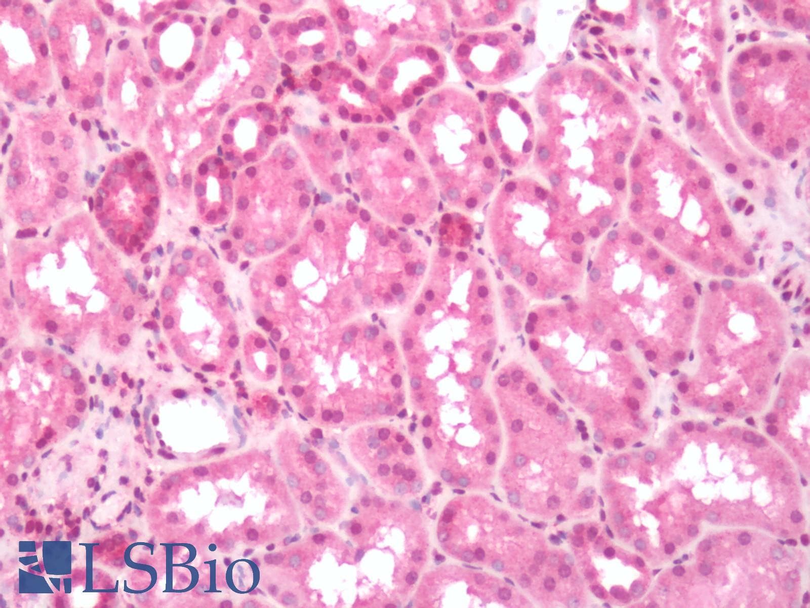 PathPlus™ Polyclonal Rabbit anti-Human PTGER3 / EP3 Antibody (N-Terminus, IHC)