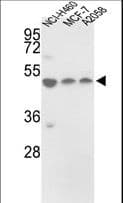 PDIA6 / ERP5 Antibody (aa236-264)