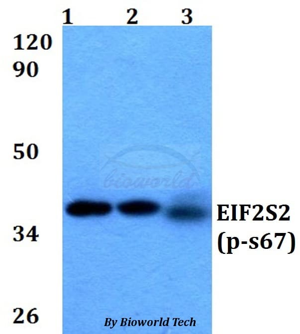 EIF2S2 Antibody (phospho-Ser67)