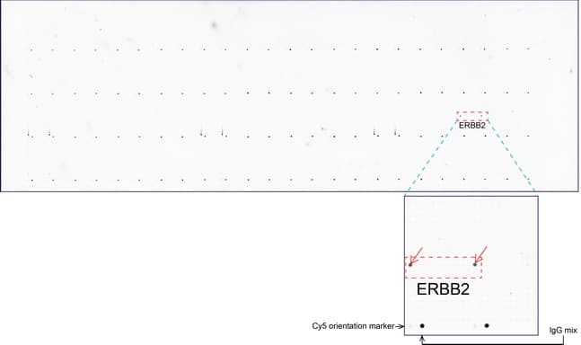 ERBB2 / HER2 Antibody (aa676-1255, clone UMAB35)