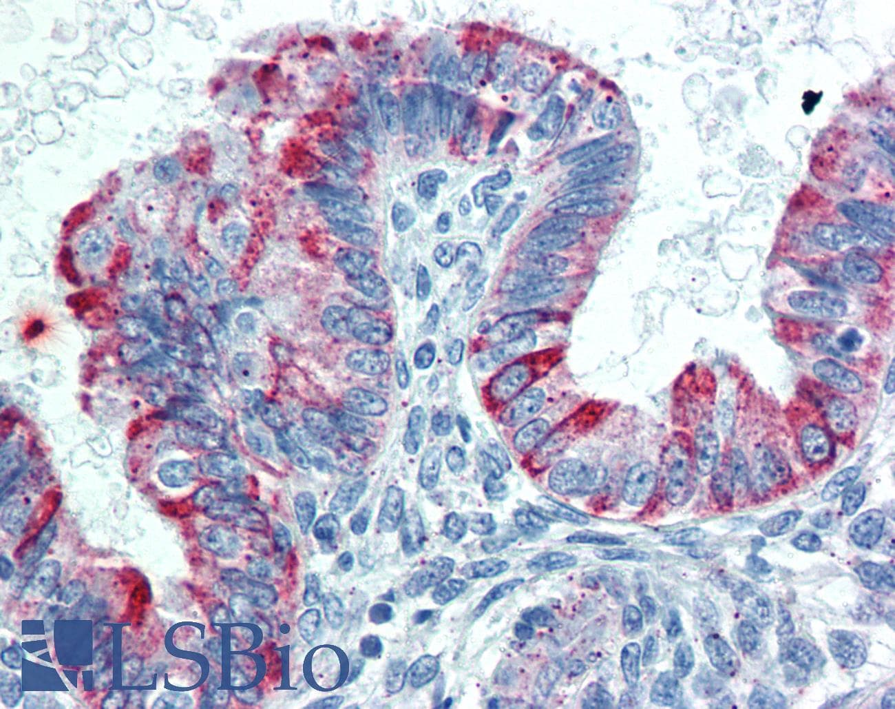 PathPlus™ TNFRSF14 / CD270 / HVEM Antibody (clone 2G6-2C7)