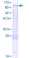 Human PFKL Protein (Recombinant GST)