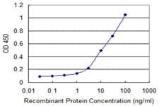 HLA-DQA1 Antibody (clone 1A3)