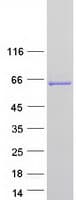 Human MTMR6 Protein (Recombinant Myc-DDK (Flag))