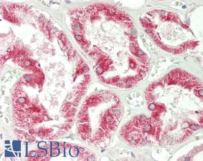 IHC-plus™ Polyclonal Rabbit anti-Human SIRT3 / Sirtuin 3 Antibody (IHC, WB)