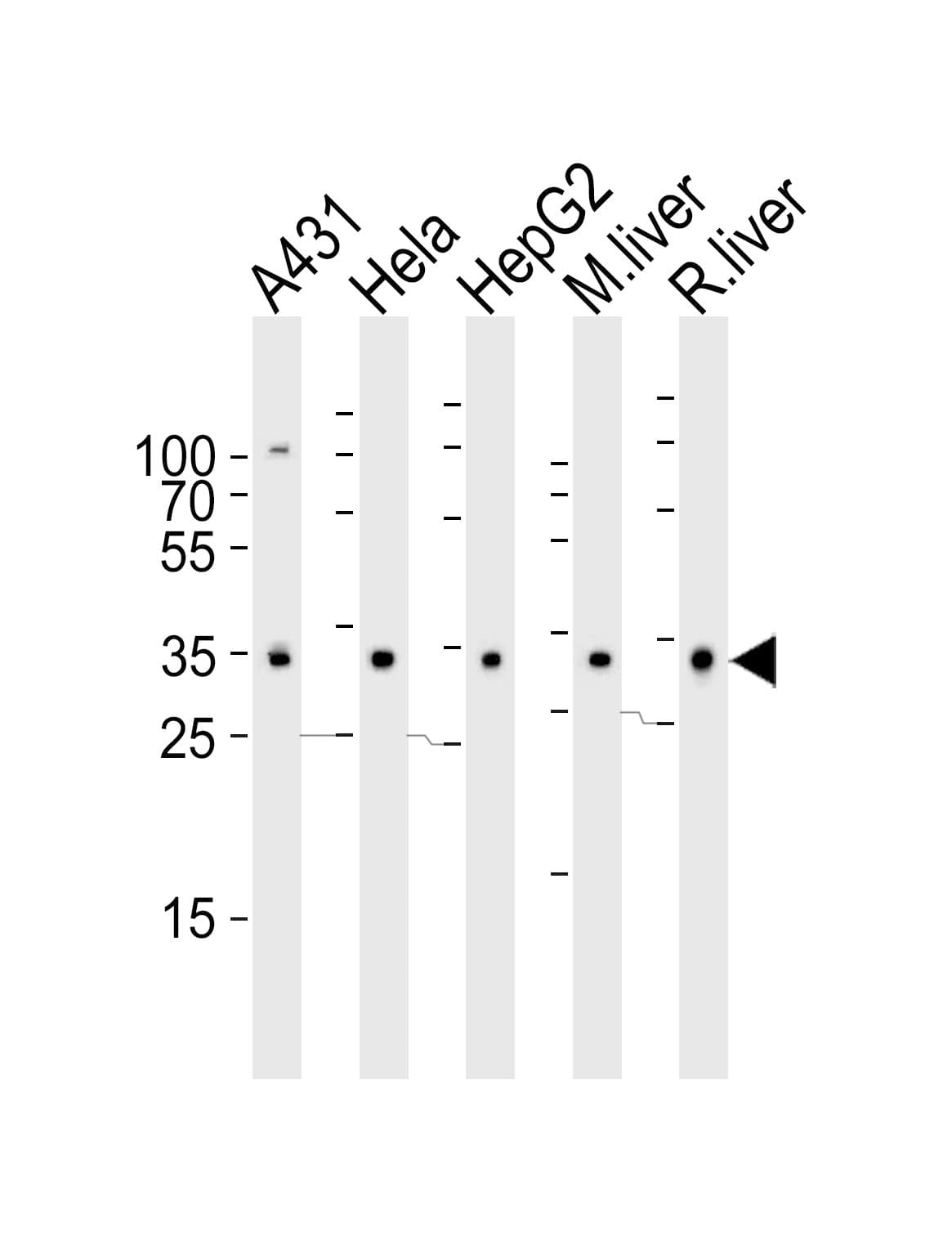 Polyclonal Rabbit anti-Human CYB5R3 / B5R Antibody (aa111-144, WB)