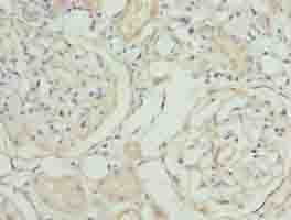 Polyclonal Rabbit anti-Human MAT2A Antibody (IHC)