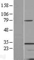 Hypothetical Protein / TINP1 (Over-Expression Lysate Myc-DDK (Flag))