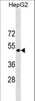 PathPlus™ ST6GAL1 / CD75 Antibody (aa178-206)