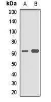 SLC1A6 / EAAT4 Antibody