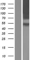 Human CRFR1 / CRHR1 Protein (Over-Expression Lysate Myc-DDK (Flag))