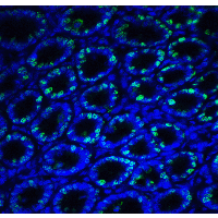 IHC-plus™ ERN1 / IRE1 Antibody