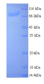 Bacillus thuringiensis Crystal Protein cry3Aa (Recombinant His)