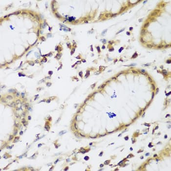 E6AP / UBE3A Antibody
