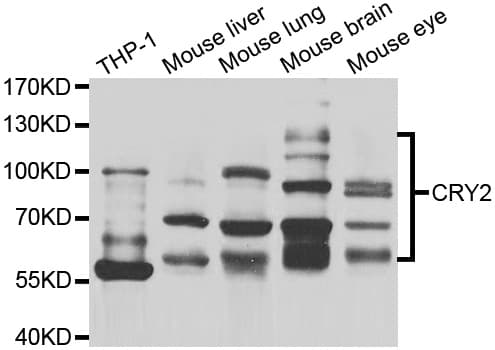 IHC-plus™ CRY2 Antibody
