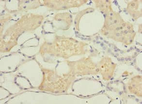 Polyclonal Rabbit anti-Human DPYS / Dihydropyrimidinase Antibody (IHC, WB)