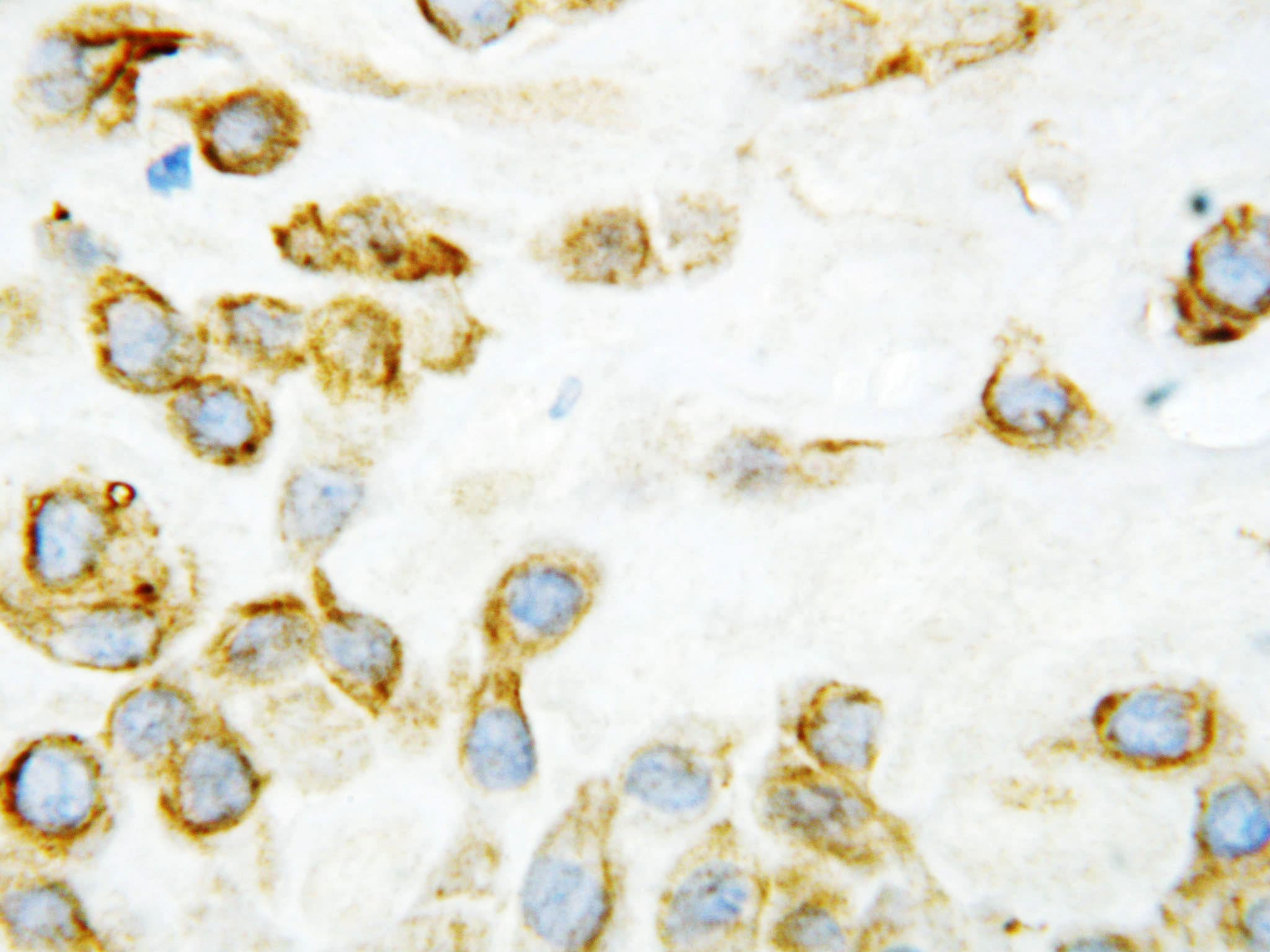 THBS2 / Thrombospondin 2 Antibody (aa637-655)