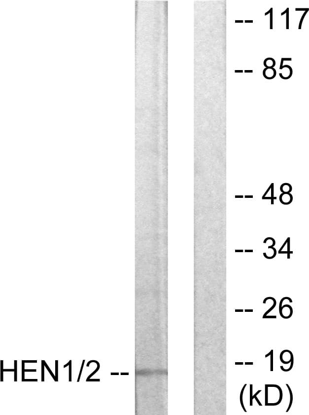 Polyclonal Rabbit anti-Human HEN1 + HEN2 Antibody (aa41-90, WB)