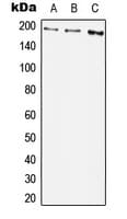 PDGFRB / PDGFR Beta Antibody (phospho-Tyr1009)