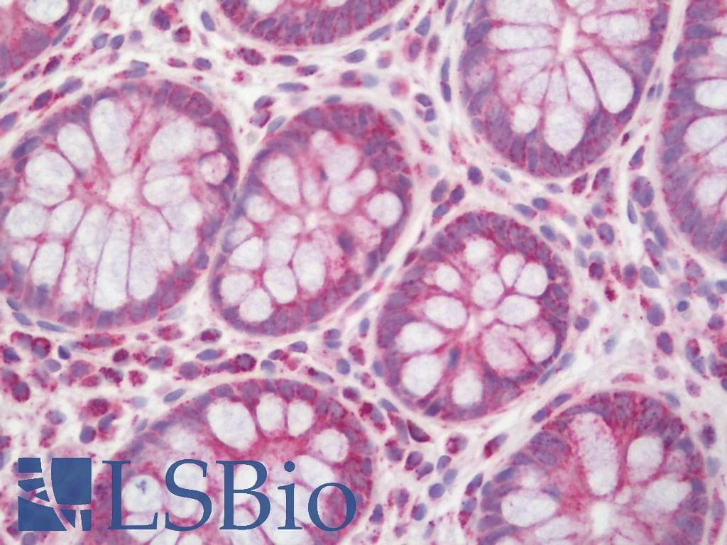 IHC-plus™ PTPN11 / SHP-2 / NS1 Antibody (aa508-557)