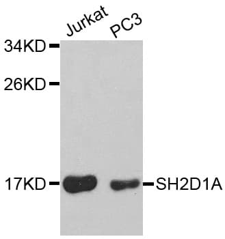 IHC-plus™ SH2D1A / SAP Antibody
