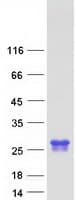 Human GGCT Protein (Recombinant Myc-DDK (Flag))